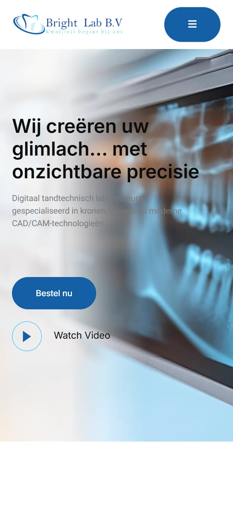 Bright Lab — موقع لمختبر أسنان رقمي يعرض خدمات مثل التيجان والجسور والقشور التجميلية والتصميم (2)